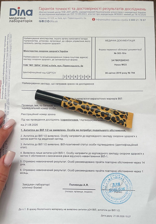Анализ на СПИД